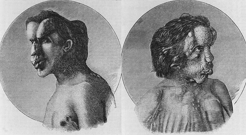 ג'וזף מריק, איש הפיל