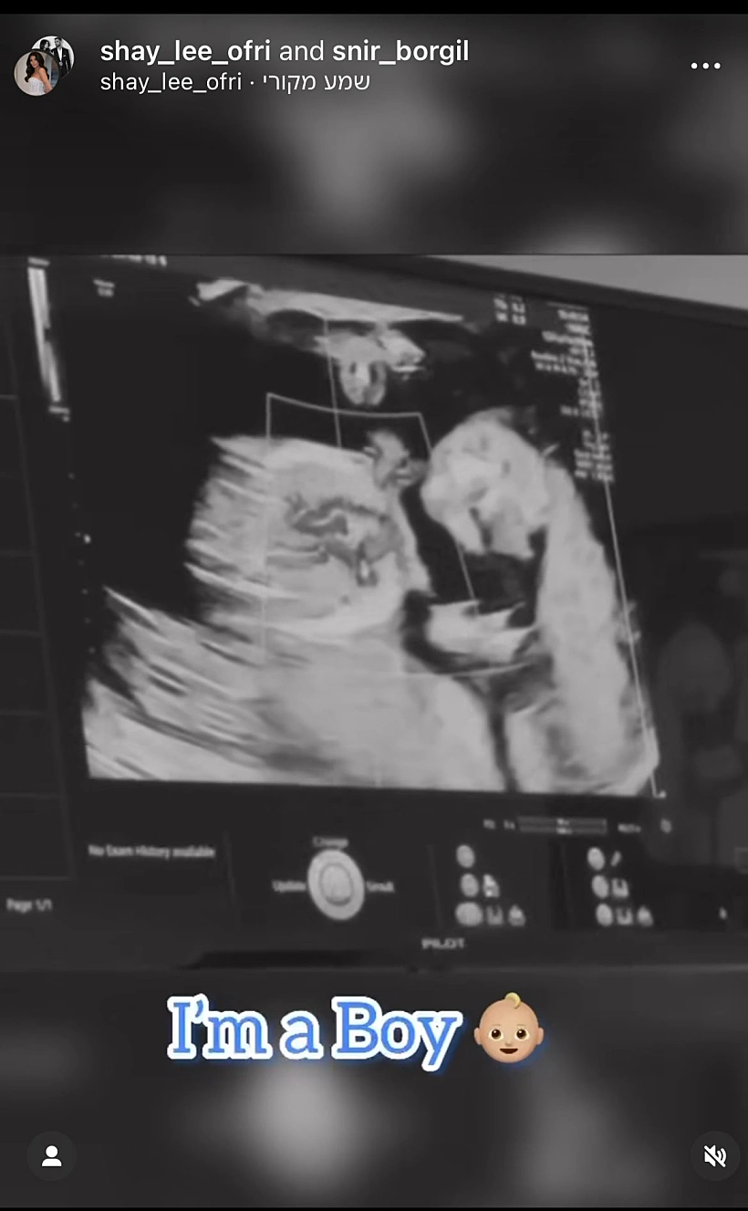 הבייבי של שי ושניר