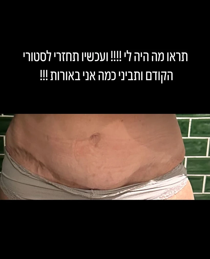 עדי בוזגלו