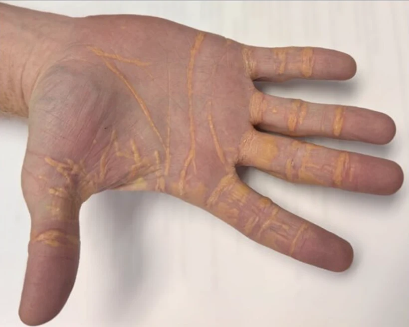 Jama Cardiology1