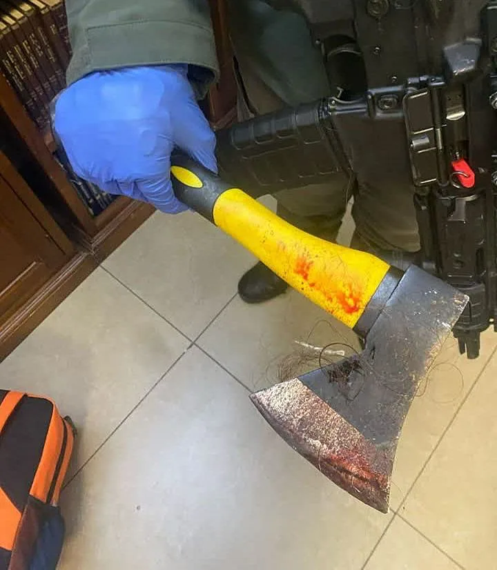 תושבת ירושלים הותקפה בגרזן