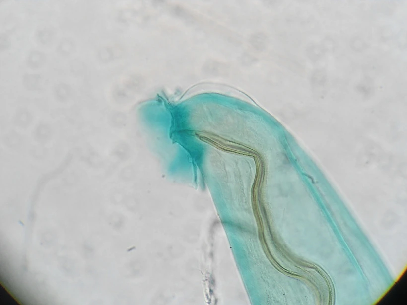 Parasite,name's,angiostrongylus,cantonensis,or,rat,lungworm,,it's,a,round