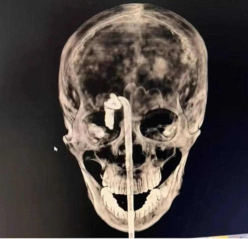 Skull 4