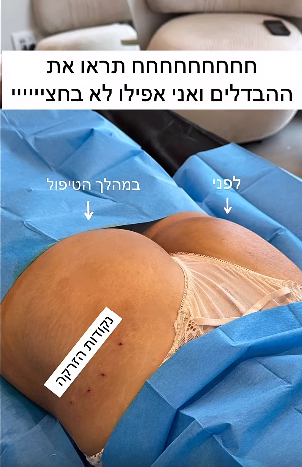 לינור סביניק