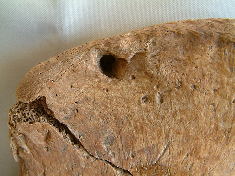 Bite Marks Reveal A Gladiator's Fatal Encounter With A Lion In Ancient Britain