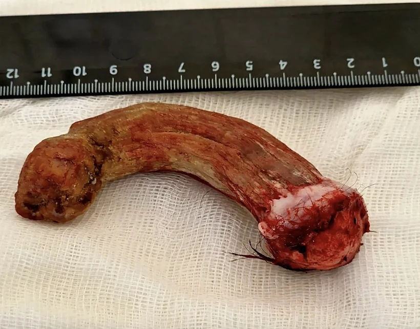 Horn 1