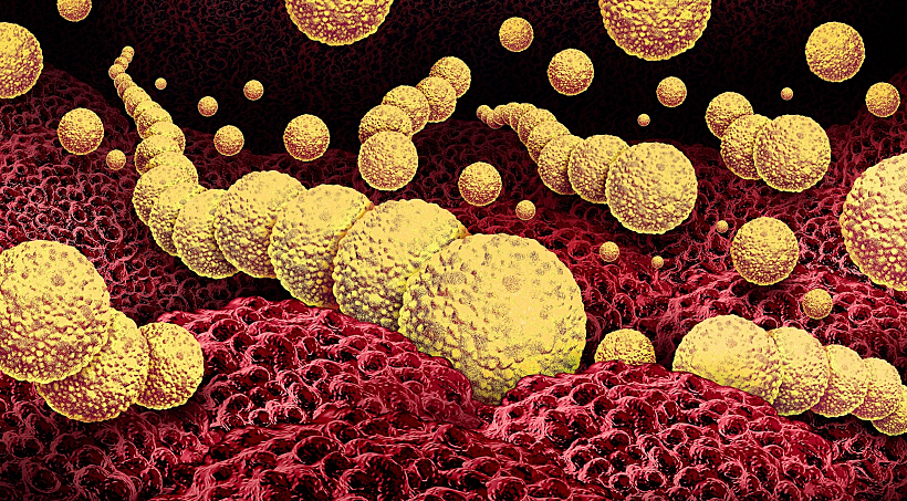 Flesh,eating,bacteria,or,flesh Eating,bactrial,infection,as,a,dangerous