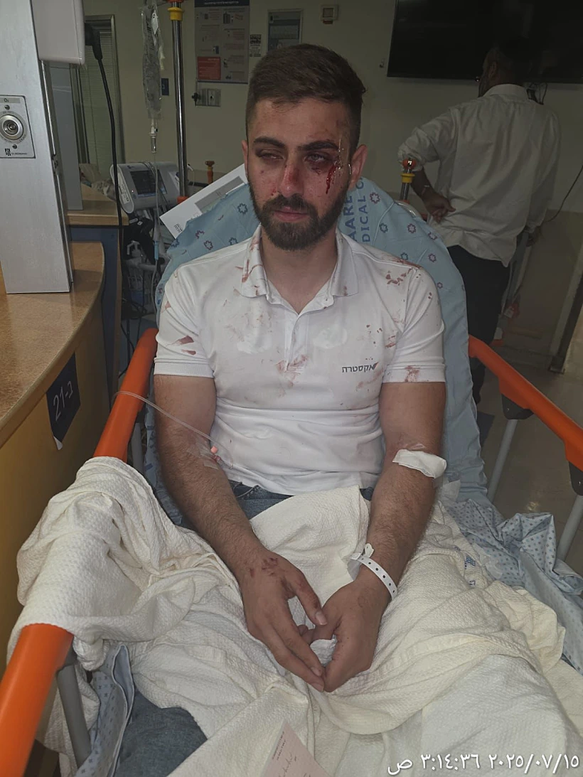 נהג האוטובוס שהותקף בירושלים