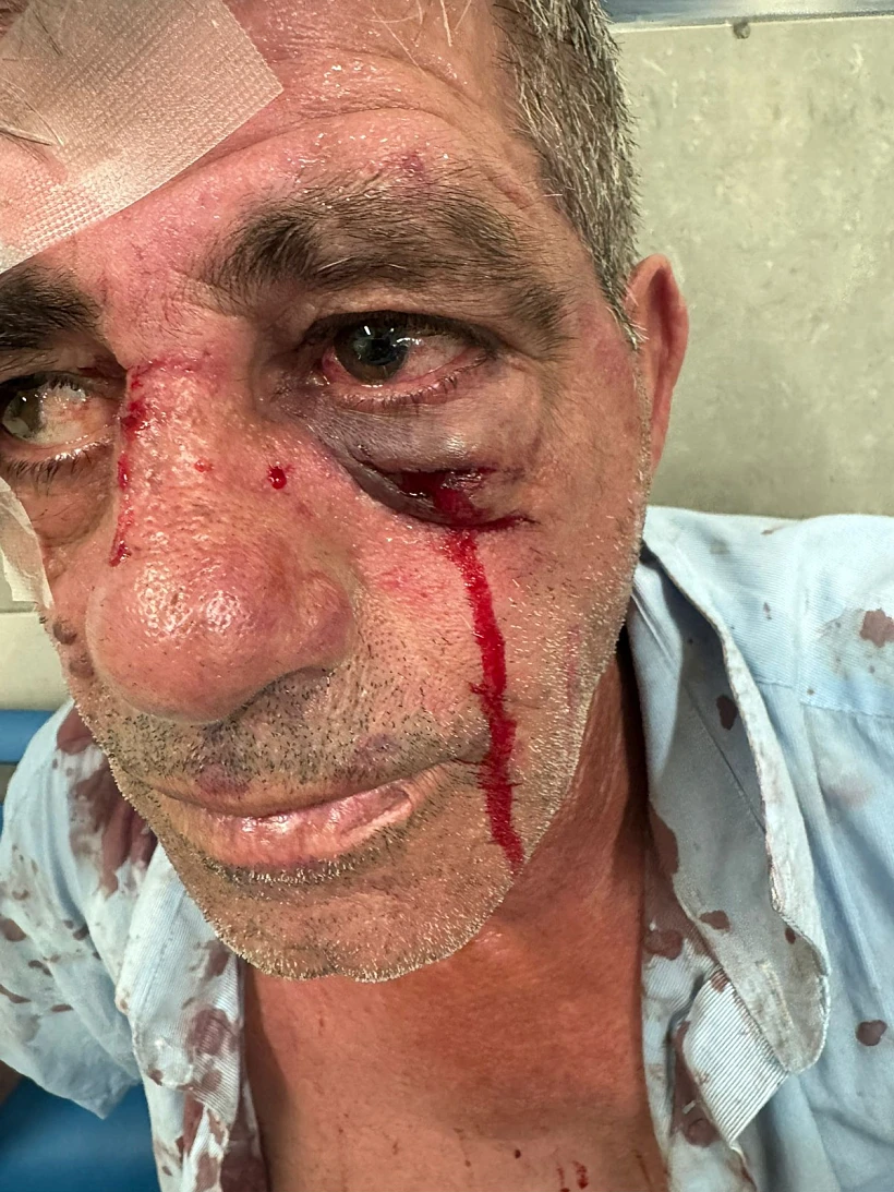 נהג האוטובוס שהותקף בטבריה