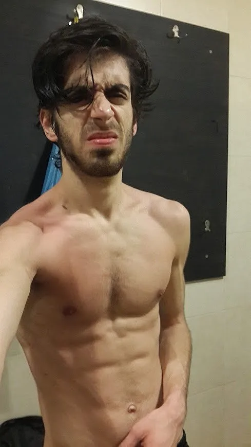 טל סודאי בתקופת ההתמודדות עם האנורקסיה