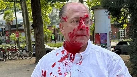 סשה סטבסקי שהותקף בפרנקפורט