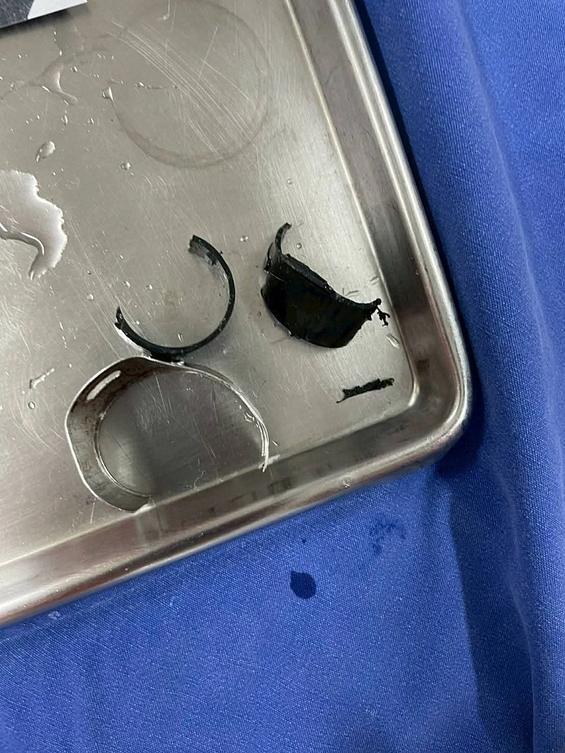 נעל את איבר מינו עם טבעות פלדה ופלסטיק