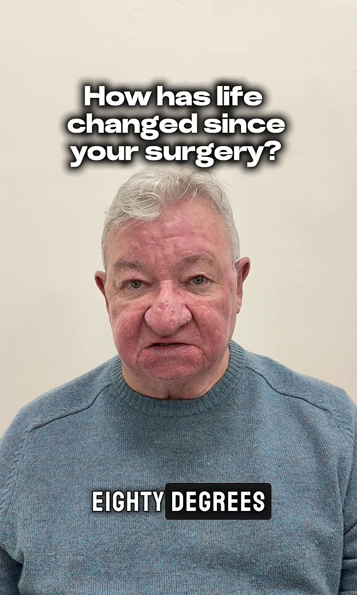 גראלד מקאליס, לאחר הניתוח