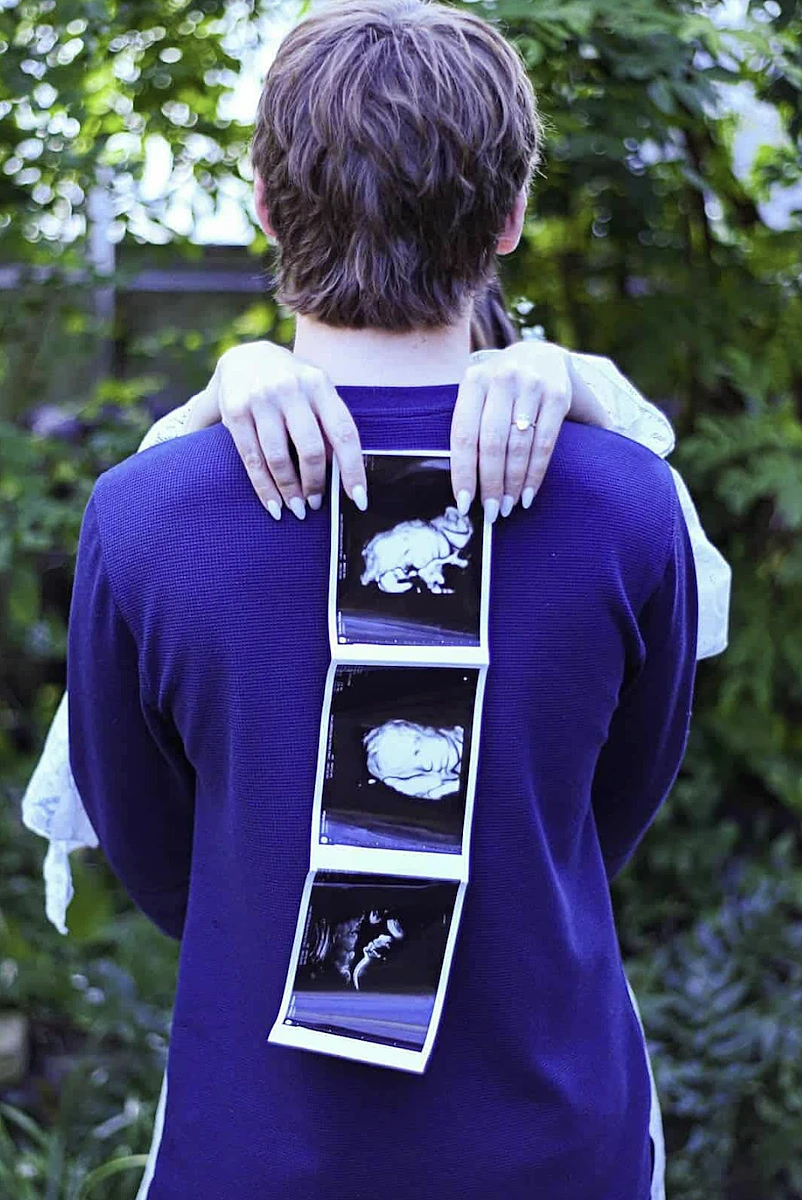 רובין פולסטון, הנער וצילומי האולטרסאונד של העובר