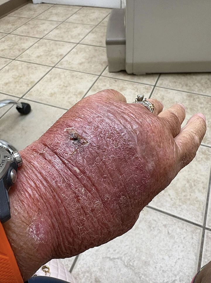 היד של מלינדה