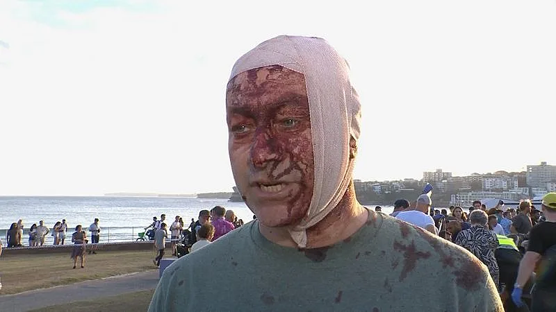 שרד את 7 באוקטובר - ונפצע בפיגוע בסידני