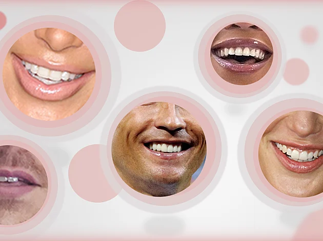 מצליחים לזהות של מי החיוך הזה?