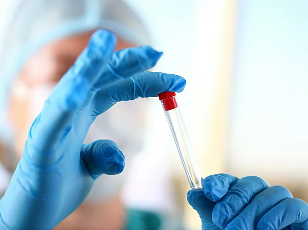 מדען הרעיל קולגה לעבודה - רק בשביל לקבל במקומו קידום