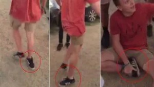 רץ ברשת - זה חייב לכאוב: מבלה בפסטיבל שבר את רגלו - והמשיך ללכת כשקרסולו פונה לכיוון הנגדי
