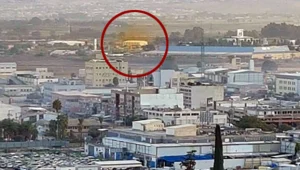 "צריבות וקשיי נשימה"