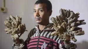 "איש העץ" יכול להרים שוב את בתו