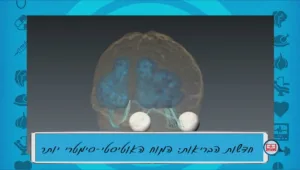 שנהיה בריאים עם פרופ' איתן פרידמן