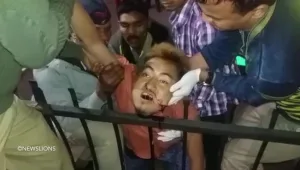 זאת ככל הנראה הפציעה המזעזעת בעולם