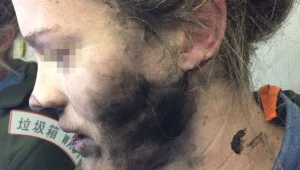 "האוזניות התפוצצו לי על הראש והמשיכו לבעור"