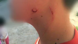 מנהל בית ספר בצפון הכה תלמיד עם מוט ברזל