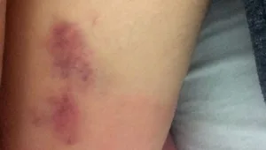 "ראיתי את השטן מכה את בתי"