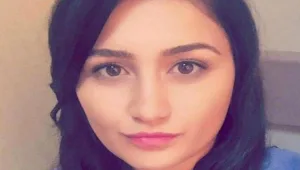 בת 22 עלולה לאבד את שפתיה בעקבות ניתוח שהסתבך