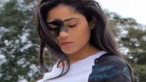 האישה שנולדה עם כתם לידה גדול על פניה