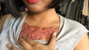 כדאי שתראו מה קרה לאישה הזאת