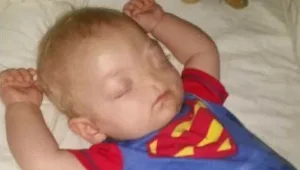 הפעוט "חסר האף" נפטר בגיל שנתיים בלבד