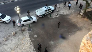 שוטרת נפצעה אנוש בפיגוע בי-ם