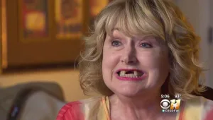 והתעוררה ללא שיניים קדמיות