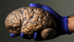  הצצה למוח האנושי