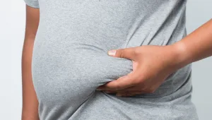 הקפאת שומן באמצעות טכנולוגיה חדשנית