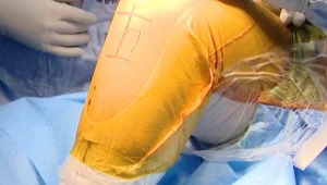 "Waze למנתחים": מכשיר חדש מזהה את האנטומיה המדויקת של החולים