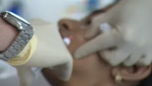 "כאבי תופת": המדינה לא מפקחת על ענף האסתטיקה, המטופלים בסכנה