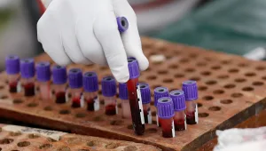 בדיקות הסרטן השגויות: משרד הבריאות יזמן חולים לבדיקה חוזרת