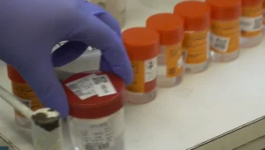 "בלתי נסלח": הטעויות בבדיקות המעבדה שעלולות לגבות מחיר כבד