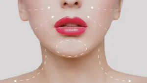 מודל היופי: מה נשים באמת רוצות בתחום הטיפולים האסתטיים?