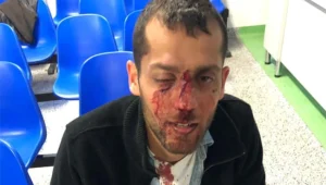 2 ישראלים הותקפו בוורשה: "קראו 'לשחרר את עזה' - והיכו אותנו"