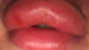 "איים שיזריק לנו חומר מסרטן": תיעוד נפגעות "המומחה הפלסטי"