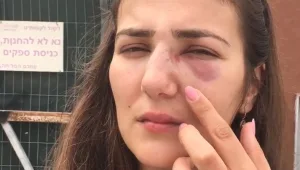 האלימות בכבישים: מה עושה המשטרה כדי למגר את ההפקרות?