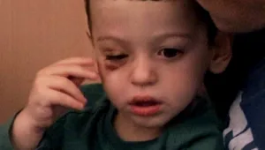 הפנים מאחורי תאונות הדרכים: יומן ההתמודדות של ורה ובנה בן ה-4 שניצלו מתאונה קשה