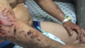 צלף במיל', שומר של עבריין בכיר: המאבטח שנפצע בירי בגבעתיים מדבר מביה"ח