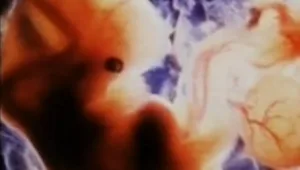 חיים בריא: מהן הסיבות להפלות חוזרות?