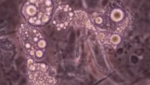 חיים בריא: 14.07.16